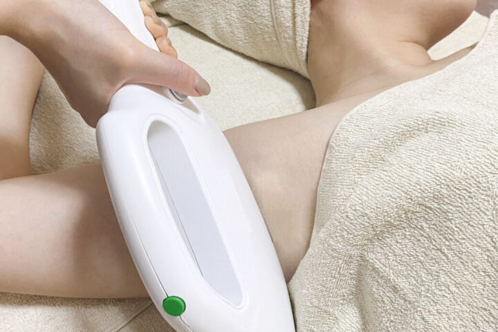 脱毛の無料体験